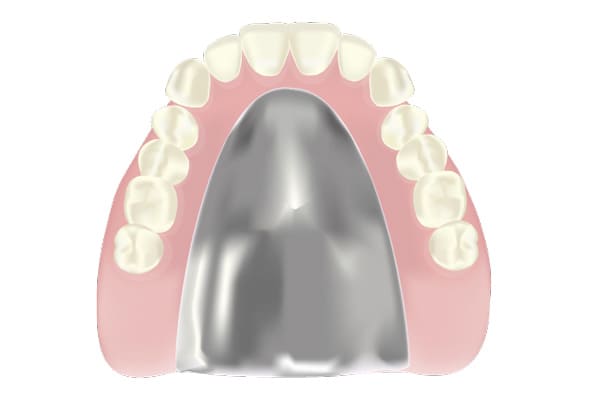 金属床義歯